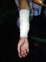 Fotos - Garota de 17 anos é agredida à facadas em Santa Eudoxia - Foto 3 de 5