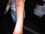 Fotos - Garota de 17 anos é agredida à facadas em Santa Eudoxia - Foto 2 de 5