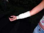 Fotos - Garota de 17 anos é agredida à facadas em Santa Eudoxia - Foto 1 de 5